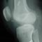 Injury and Suspension Latest Injury and Suspension Latest
